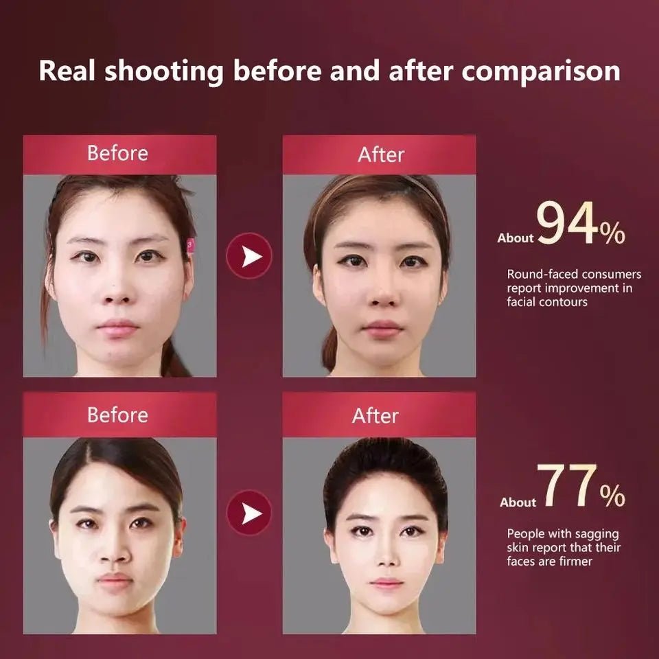 Facial Lifting Massager 12 Gears Electric Facial Massager V - line Face Lifting Slimming Vibration Device Home Use Beauty Tool - TRENSET