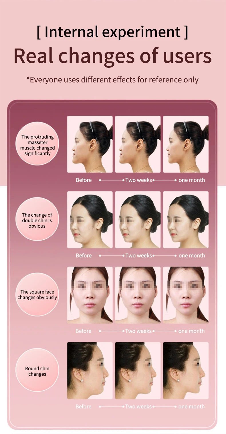 Facial Lifting Massager 12 Gears Electric Facial Massager V - line Face Lifting Slimming Vibration Device Home Use Beauty Tool - TRENSET